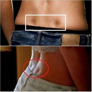If you have these two holes in your back, it means you don’t…