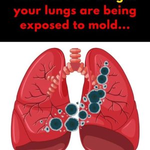 5 Signs Your Lungs are Being Exposed to Mold