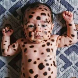 Mom shocked by her baby after birth, her words now spread like forest fire!
