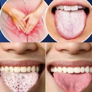 If you have a white tongue, it means that your…See more