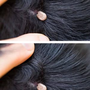 What You Should Do If You Discover Something Strange in Your Child’s Hair